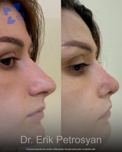 Dr. Erik Petrosyan (10)