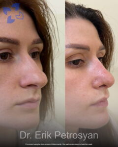 Dr. Erik Petrosyan (11)